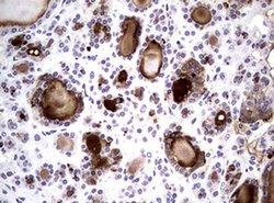 NBN Monoclonal Antibody (OTI6H7), TrueMAB , OriGene 100 &mu;L; Unconjugated:Antibodies,