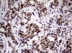 NBN Monoclonal Antibody (OTI6H7), TrueMAB , OriGene 100 &mu;L; Unconjugated:Antibodies,