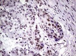 NBN Monoclonal Antibody (OTI6H7), TrueMAB , OriGene 100 &mu;L; Unconjugated:Antibodies,