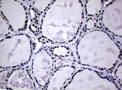 NBN Monoclonal Antibody (OTI7D5), TrueMAB , OriGene 30 &mu;L | Buy Online | Origene Technologies | Fisher Scientific