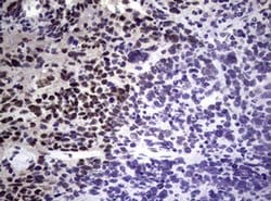 NBN Monoclonal Antibody (OTI6E11), TrueMAB , OriGene 100 &mu;L; Unconjugated:Antibodies,