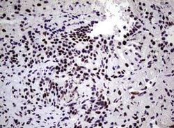 NBN Monoclonal Antibody (OTI6E11), TrueMAB , OriGene 100 &mu;L; Unconjugated:Antibodies,