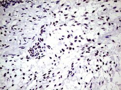 NBN Monoclonal Antibody (OTI6E11), TrueMAB , OriGene 100 &mu;L; Unconjugated:Antibodies,
