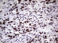 NBN Monoclonal Antibody (OTI6E11), TrueMAB , OriGene 100 &mu;L; Unconjugated:Antibodies,