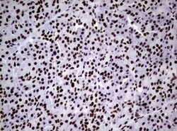 NBN Monoclonal Antibody (OTI6E11), TrueMAB , OriGene 100 &mu;L; Unconjugated:Antibodies,