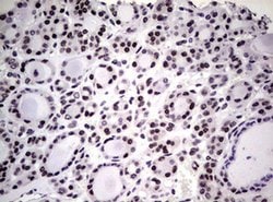 NBN Monoclonal Antibody (OTI6E11), TrueMAB , OriGene 100 &mu;L; Unconjugated:Antibodies,