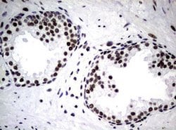 NBN Monoclonal Antibody (OTI6E11), TrueMAB , OriGene 100 &mu;L; Unconjugated:Antibodies,