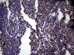 NBN Monoclonal Antibody (OTI6E11), TrueMAB , OriGene 100 &mu;L; Unconjugated:Antibodies,