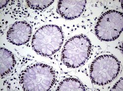 NBN Monoclonal Antibody (OTI6E11), TrueMAB , OriGene 100 &mu;L; Unconjugated:Antibodies,