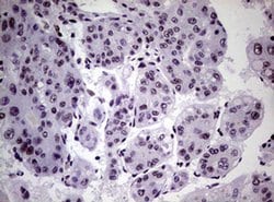 NBN Monoclonal Antibody (OTI6E11), TrueMAB , OriGene 100 &mu;L; Unconjugated:Antibodies,