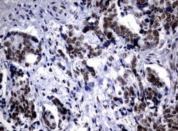 NBN Mouse anti-Human, Clone: UMAB99, liquid, UltraMAB 100 &mu;L; Unconjugated:Antibodies,