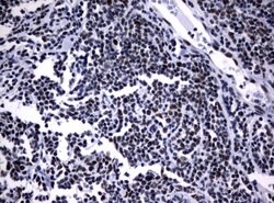 NBN Mouse anti-Human, Clone: UMAB99, liquid, UltraMAB 100 &mu;L; Unconjugated:Antibodies,