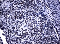 NBN Mouse anti-Human, Clone: UMAB100, liquid, UltraMAB 30 &mu;L | Buy Online | Origene Technologies | Fisher Scientific