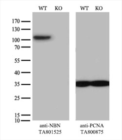 NBN Monoclonal Antibody (OTI7D5), TrueMAB , OriGene 30 &mu;L | Buy Online | Origene Technologies | Fisher Scientific