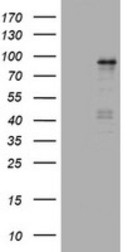 NBN Mouse anti-Human, Clone: OTI1C9, lyophilized, TrueMAB 100 &mu;g; Unconjugated:Antibodies,