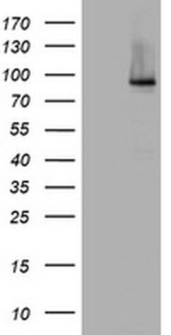 NBN Monoclonal Antibody (OTI1G10), TrueMAB , OriGene 100 &mu;L; Unconjugated:Antibodies,