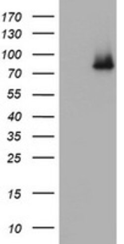 NBN Mouse anti-Human, Clone: OTI6D10, lyophilized, TrueMAB 100 &mu;g; Unconjugated:Antibodies,
