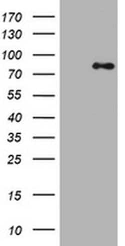 NBN Mouse anti-Human, Clone: OTI2G4, TrueMAB , Origene 30 &mu;L; Unconjugated:Antibodies,
