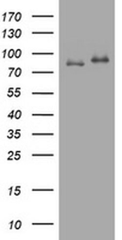 NBN Monoclonal Antibody (OTI8E7), TrueMAB , OriGene 100 &mu;L; Unconjugated:Antibodies,