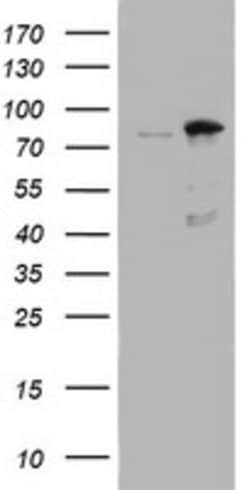 NBN Mouse anti-Human, Clone: OTI3C12, lyophilized, TrueMAB 100 &mu;g; Unconjugated:Antibodies,