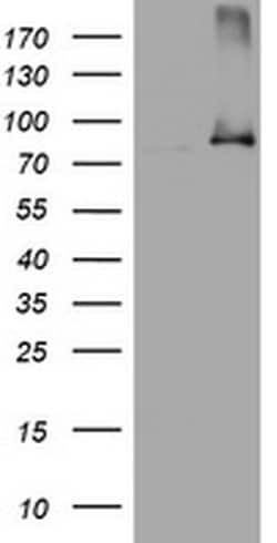NBN Monoclonal Antibody (OTI6H7), TrueMAB , OriGene 100 &mu;L; Unconjugated:Antibodies,