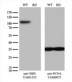 NBN Monoclonal Antibody (OTI7D5), TrueMAB , OriGene 30 &mu;L | Buy Online | Origene Technologies | Fisher Scientific