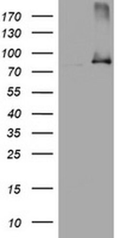 NBN Monoclonal Antibody (OTI1G8), TrueMAB , OriGene:Antibodies:Primary