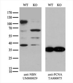 NBN Mouse anti-Human, Clone: UMAB99, liquid, UltraMAB 100 &mu;L; Unconjugated:Antibodies,