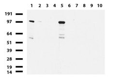 NBN Mouse anti-Human, Clone: UMAB100, liquid, UltraMAB 30 &mu;L | Buy Online | Origene Technologies | Fisher Scientific