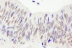 NBS1 Rabbit anti-Human, Polyclonal, Bethyl Laboratories 100 &mu;L; Unconjugated:Antibodies,