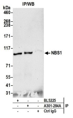 NBS1 Rabbit anti-Mouse, Polyclonal, Bethyl Laboratories 100 &mu;L; Unconjugated:Antibodies,