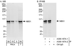 NBS1 Rabbit anti-Human, Polyclonal, Bethyl Laboratories 100 &mu;L; Unconjugated:Antibodies,