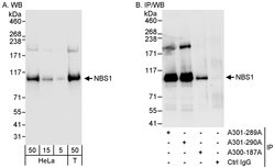 NBS1 Rabbit anti-Human, Polyclonal, Bethyl Laboratories 100 &mu;L; Unconjugated:Antibodies,