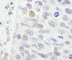 NBS1 Polyclonal Antibody, Bethyl Laboratories 10 &mu;L; Unconjugated:Antibodies,