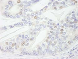 NBS1 Polyclonal Antibody, Bethyl Laboratories 10 &mu;L; Unconjugated:Antibodies,
