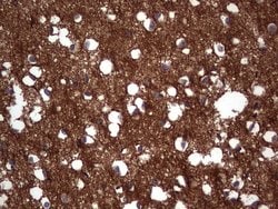 NCAM1 Monoclonal Antibody (OTI1C7), TrueMAB , OriGene 100 &mu;L; Unconjugated:Antibodies,