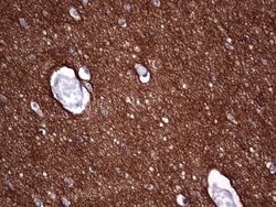 NCAM1 Monoclonal Antibody (OTI1C7), TrueMAB , OriGene 100 &mu;L; Unconjugated:Antibodies,