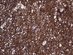 NCAM1 Monoclonal Antibody (OTI1C7), TrueMAB , OriGene 100 &mu;L; Unconjugated:Antibodies,