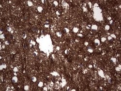 NCAM1 Mouse anti-Human, Clone: OTI2A2, lyophilized, TrueMAB 100 &mu;g;
