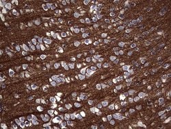 NCAM1 Mouse anti-Human, Clone: OTI2A2, lyophilized, TrueMAB 100 &mu;g;