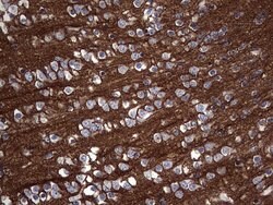 NCAM1 Monoclonal Antibody (OTI2A2), TrueMAB , OriGene 100 &mu;L; Unconjugated:Antibodies,