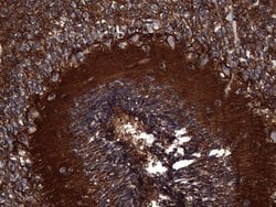 NCAM1 Mouse anti-Human, Clone: OTI2A2, lyophilized, TrueMAB 100 &mu;g;