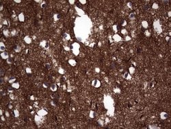 NCAM1 Monoclonal Antibody (OTI3H2), TrueMAB , OriGene:Antibodies:Primary