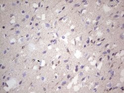 NCAM1 Monoclonal Antibody (OTI2F6), TrueMAB , OriGene 100 &mu;L; Unconjugated:Antibodies,