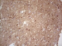 NCAM1 Monoclonal Antibody (OTI1B9), TrueMAB , OriGene 100 &mu;L; Unconjugated:Antibodies,