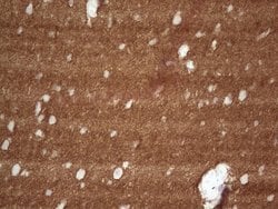 NCAM1 Mouse anti-Human, Clone: OTI1B9, lyophilized, TrueMAB 100 &mu;g;