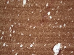 NCAM1 Monoclonal Antibody (OTI1B9), TrueMAB , OriGene 100 &mu;L; Unconjugated:Antibodies,