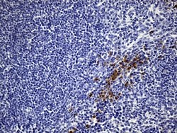 NCAM1 Mouse anti-Human, Clone: UMAB83, lyophilized, UltraMAB 100 &mu;g;
