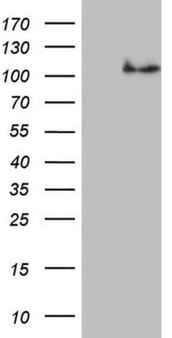 NCAM1 Monoclonal Antibody (OTI1C7), TrueMAB , OriGene 100 &mu;L; Unconjugated:Antibodies,