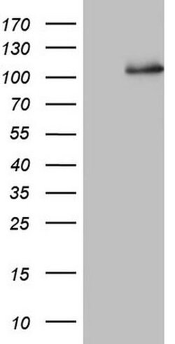 NCAM1 Monoclonal Antibody (OTI2C3), TrueMAB , OriGene 100 μL; Unconjugated:Antibodies,